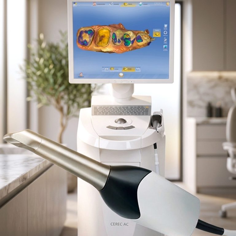INTRA ORAL SCANNER